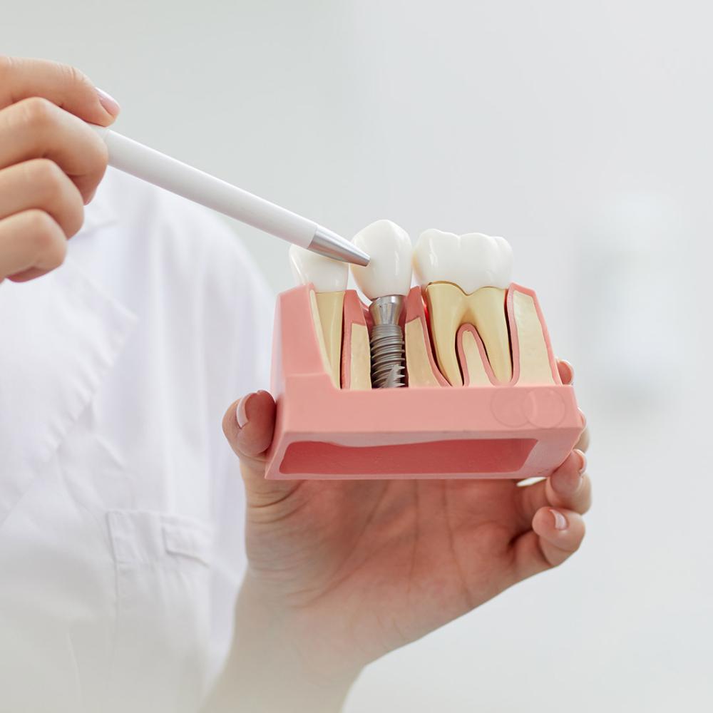 Implantodontia Implantodontia