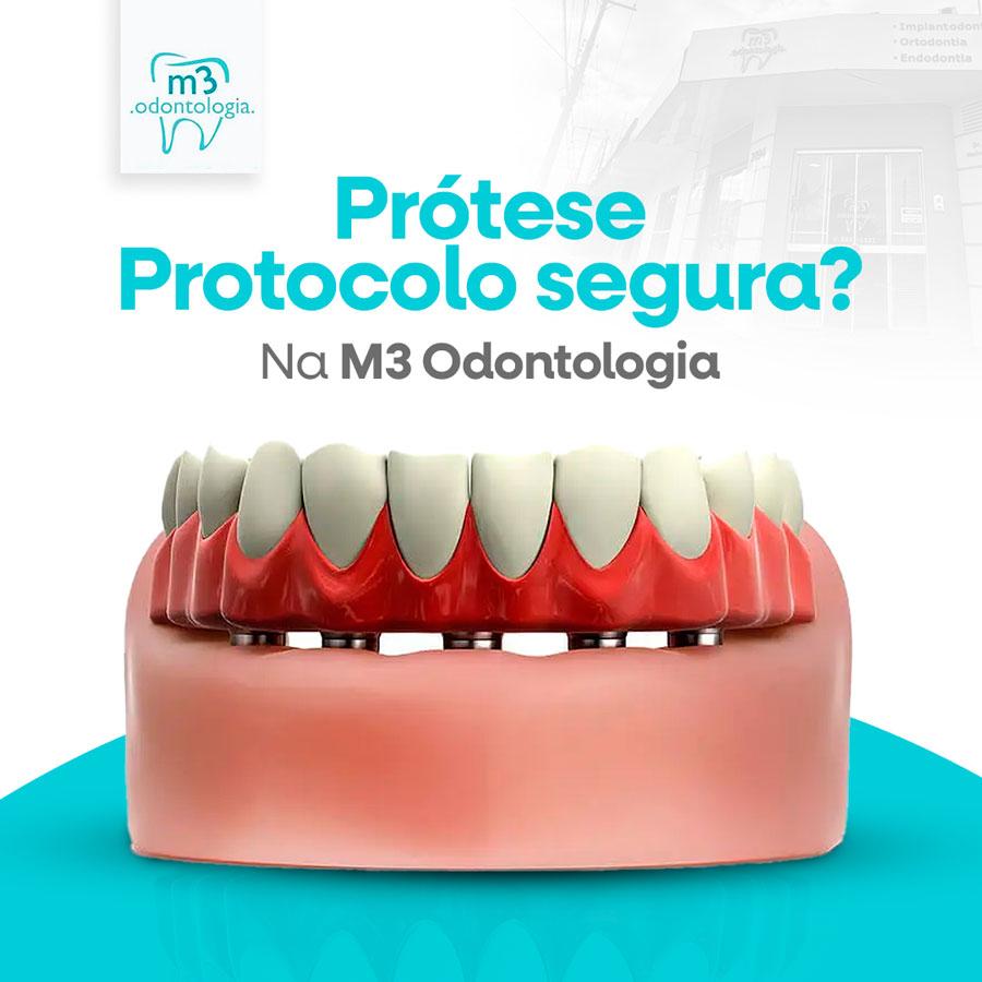 Você sabia que a prótese tipo protocolo é uma solução segura e eficaz para a reabilitação do sorriso? Você sabia que a prótese tipo protocolo é uma solução segura e eficaz para a reabilitação do sorriso?